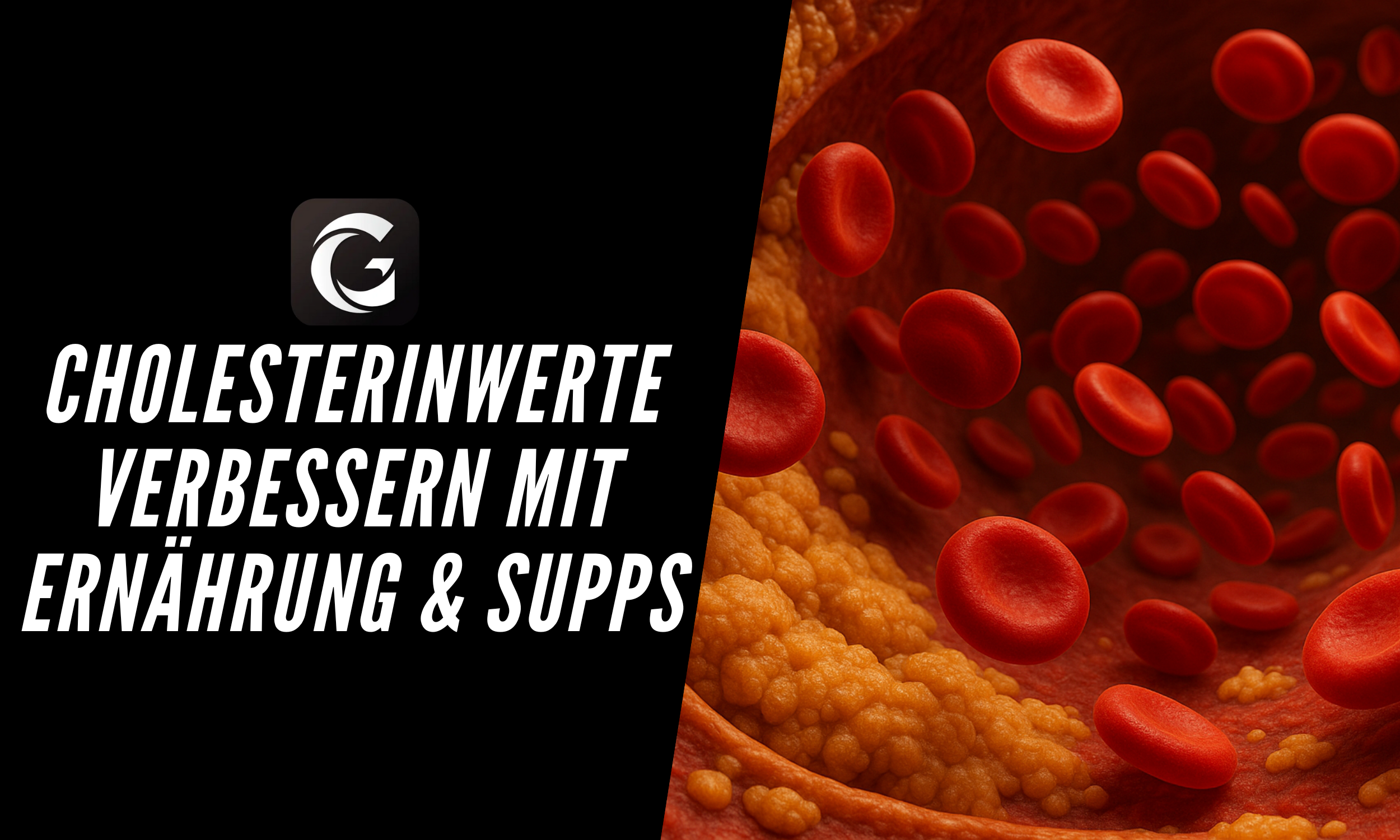 Cholesterinwerte verbessern mit Ernährung & Supplements